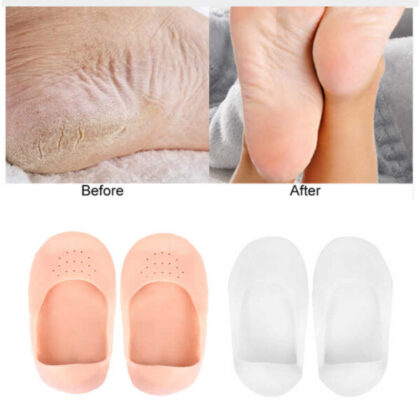 2 Pairs : Moisturizing No Show Socks – Gel Boat Socks for Dry Cracked Feet Socks for Relieve Heel Pain